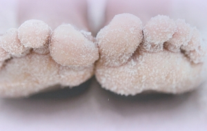 Les pieds gelés